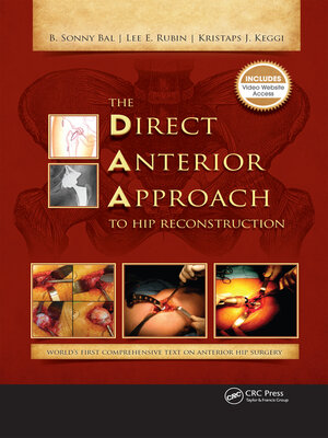 cover image of The Direct Anterior Approach to Hip Reconstruction